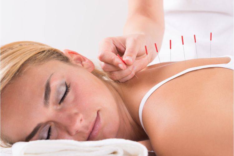Holistic Approaches Combining Chiropractic Care with Acupuncture