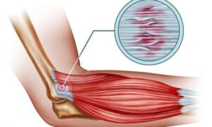 chiropractic treatment in Dwarka for back pain relief